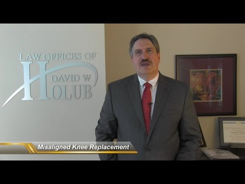 Misaligned Knee Replacement